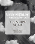 Microneedling (Full Face) + PDRN (Salmon DNA)  - 3 Sessions