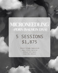 Microneedling (Full Face) + PDRN (Salmon DNA)  - 5 Sessions